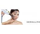 Exkluzivní kosmetické ošetření - Carbon Peel laser | Slevici