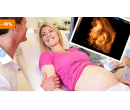 4D ultrazvuk vašeho miminka se snímky a videem | Amplion