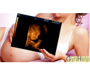 4D ultrazvuk v GynHelp | Nakup v Akci