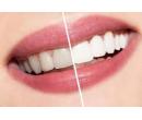 NEPEROXIDOVÉ bělení zubů | Hyperslevy