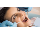 Hodinová dentální hygiena | Slevomat