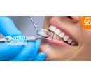 Dentální hygiena s možností airflow | Hyperslevy