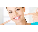 Ordinační bělení zubů | Slevomat