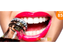 Neperoxidové bělení zubů  | Hyperslevy