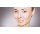 Chemický peeling pro obnovu pokožky | Slevomat