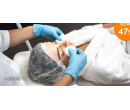Kosmetické ošetření pleti | Hyperslevy