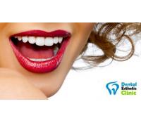 Bezchybný chrup s pomocí Dental Esthetic Clinic | Nakup v Akci