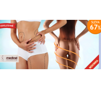 Liposukce jedné partie | Hyperslevy