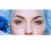 Operace horních nebo dolních očních víček | Slevomat
