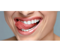 Kompletní dentální hygiena včetně Air-flow | Slevomat