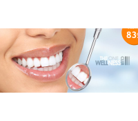 40min. bezbolestné neperoxidové bělení zubů  | Hyperslevy