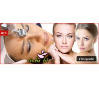 Dermarollerová mezoterapie(Jablonec nad Nisou) | Slevomat